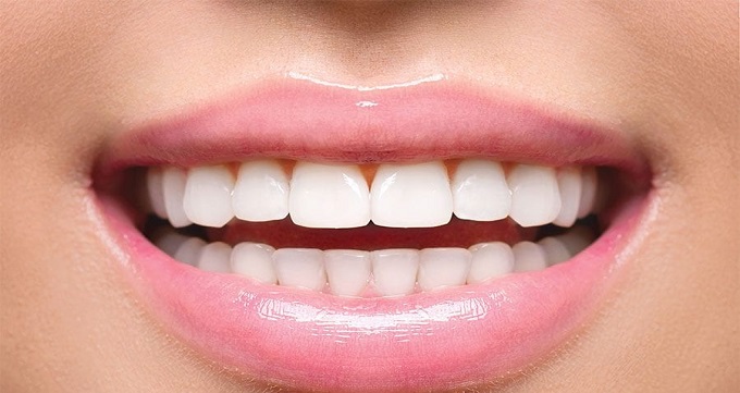 انواع خدمات زیبایی دهان و دندان