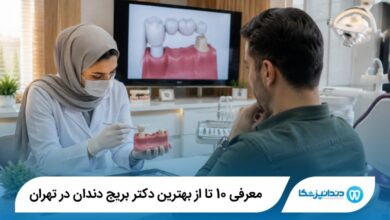 بهترین دکتر بریج دندان در تهران