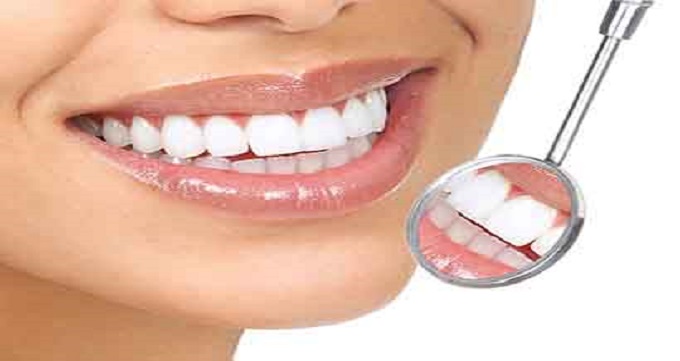 تفاوت لمینت دندان، ایمپلنت و کراون چیست؟