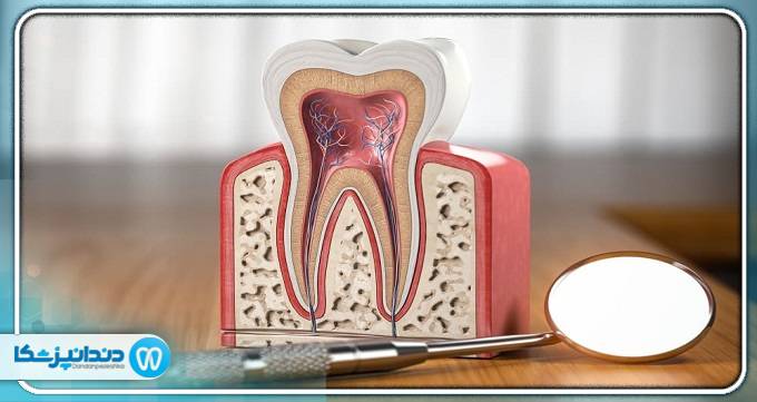 بهترین دندانپزشک درمان ریشه در رشت