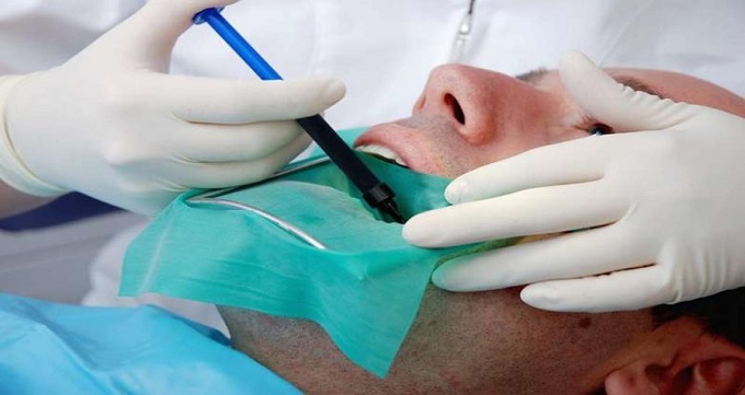 منظور از درمان ریشه دندان چیست؟
