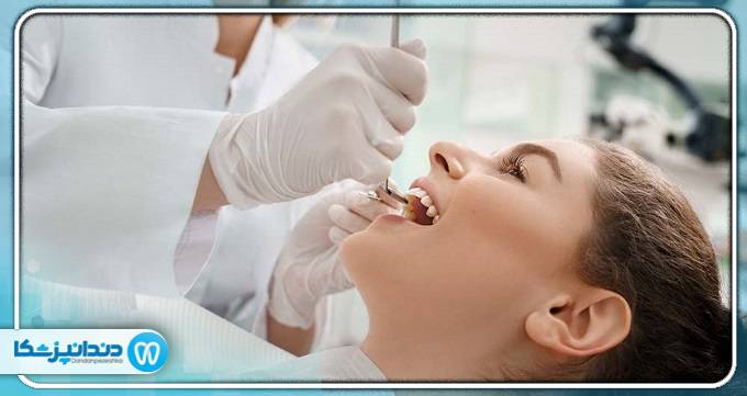 بهترین دندانپزشک درمان ریشه در زعفرانیه