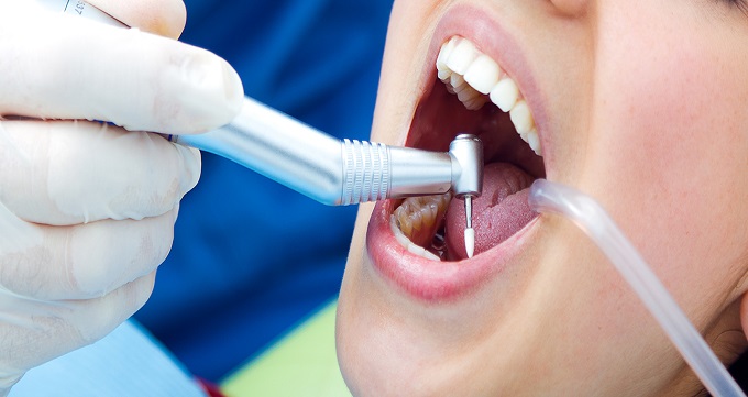 ویژگی های بهترین دندانپزشک درمان ریشه در زعفرانیه