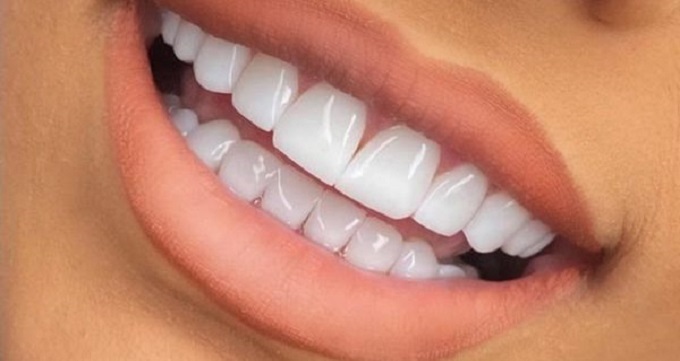 طول عمر کامپوزیت دندان چه قدر است؟