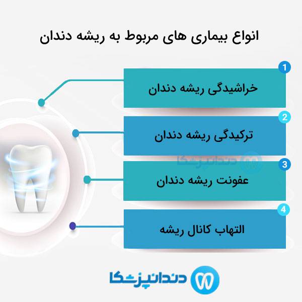 منظور از درمان ریشه دندان چیست؟