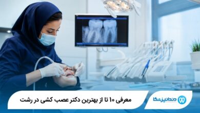 بهترین دکتر عصب کشی در رشت