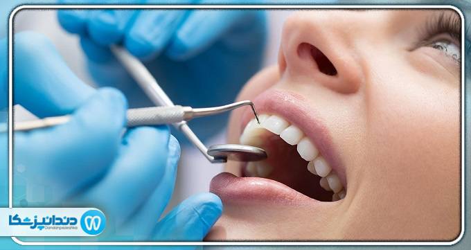 بهترین دندانپزشک درمان ریشه در ایران