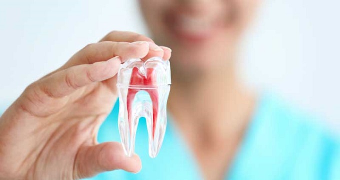 ملاک انتخاب بهترین دندانپزشک درمان ریشه در ایران