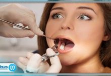 بهترین دندانپزشک درمان ریشه در ستارخان