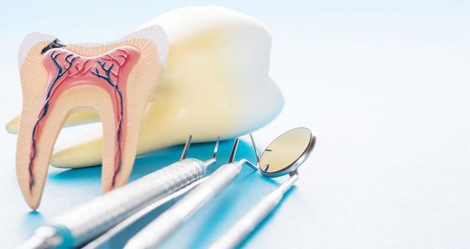 ویژگی های بهترین دندانپزشک درمان ریشه در ستارخان