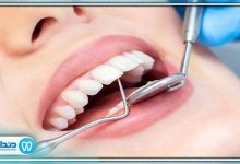 تفاوت های ایمپلنت دندان و بریج دندان