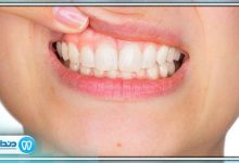 علائم و نشانه های عفونت دندان چیست؟