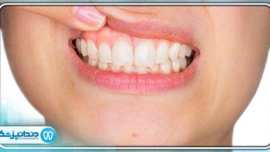 علائم و نشانه های عفونت دندان چیست؟