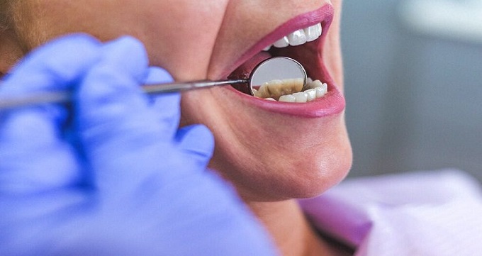 علائم و نشانه های عفونت دندان 