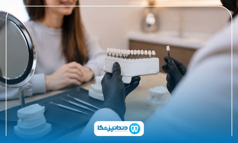 مراحل انجام لمینت دندان توسط متخصص در ستارخان