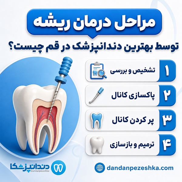 راهنمای انتخاب بهترین دندانپزشک درمان ریشه در قم+ جدول