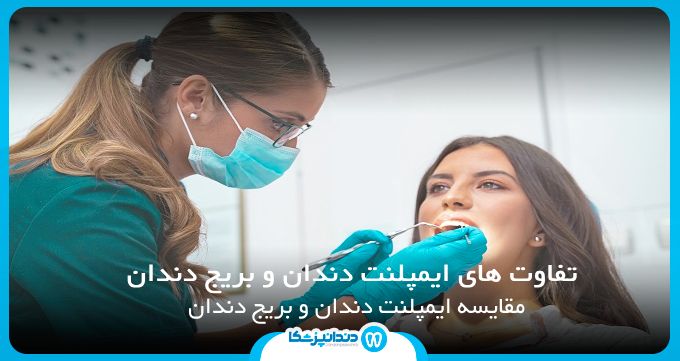 تفاوت های ایمپلنت دندان و بریج دندان