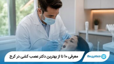 معرفی 10 تا از بهترین دکتر عصب کشی در کرج