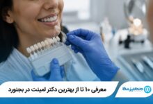 بهترین دکتر لمینت در بجنورد