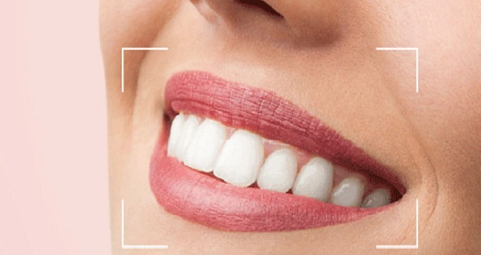 کامپوزیت دندان و مراحل انجام آن