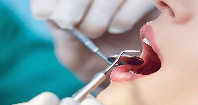 انواع جراحی های قابل انجام برای دهان و دندان