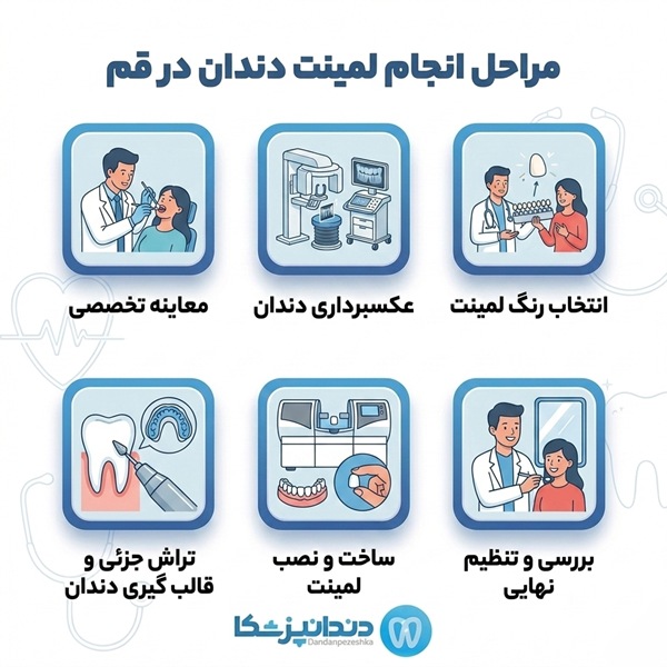چطور بهترین متخصص لمینت در قم را پیدا کنیم؟