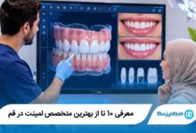 بهترین متخصص لمینت در قم