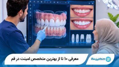بهترین متخصص لمینت در قم