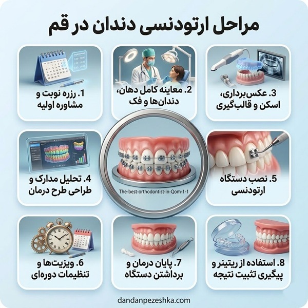 مراحل ارتودنسی دندان در قم