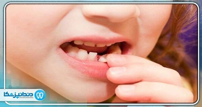 بهترین دندانپزشک کودکان در قم