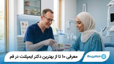 معرفی 10 تا از بهترین دکتر ایمپلنت در قم