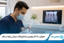معرفی 10 تا از بهترین دندانپزشک درمان ریشه در قم