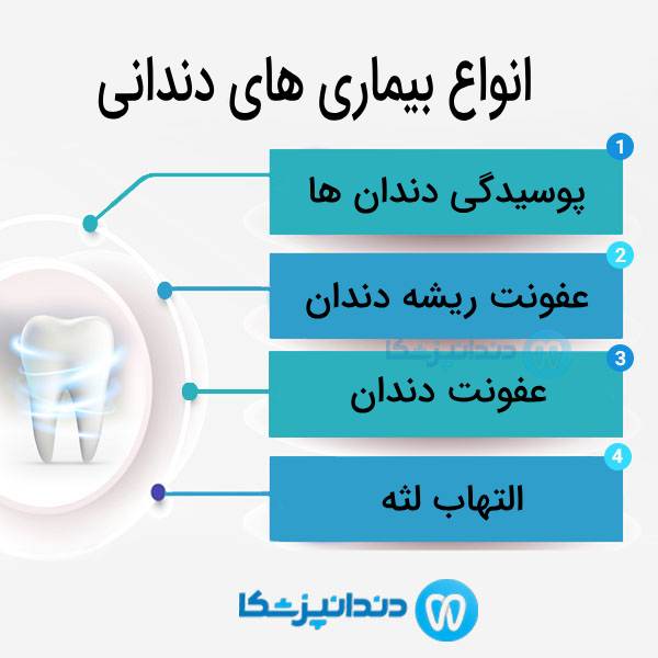 علل اصلی از دست رفتن دندان ها چیست؟
