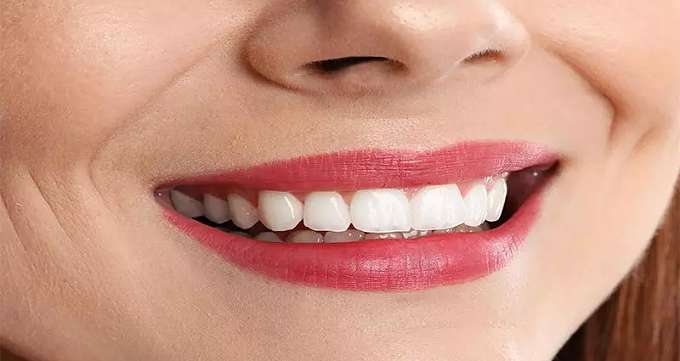 بهترین راهکارهای کاهش معایب بلیچینگ دندان در یزد