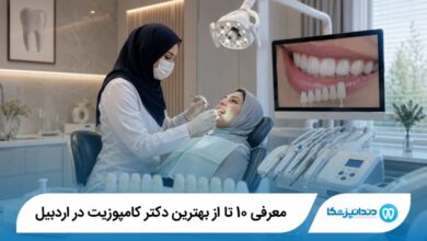 بهترین دکتر کامپوزیت در اردبیل