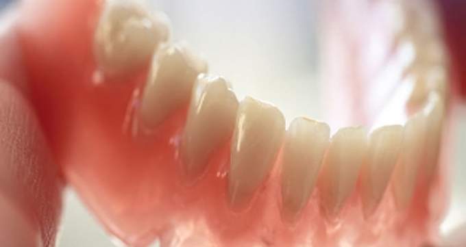 پروتز دندان ثابت بهتر است یا متحرک