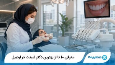 بهترین دکتر لمینت در اردبیل