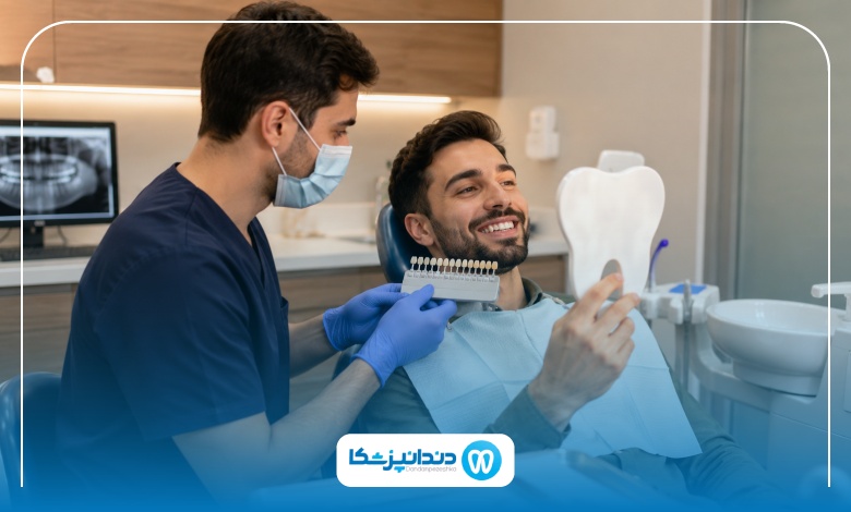 فرق لمینت سرامیکی و کامپوزیتی چیست؟