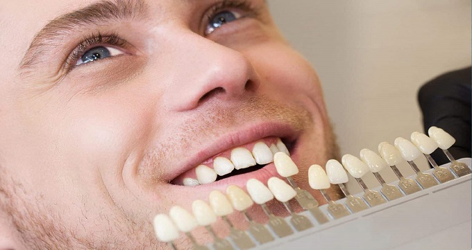 آیا لمینت باعث خرابی دندان ها می شود؟