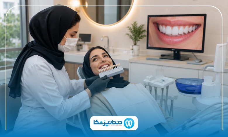 انواع لمینت دندان در یزد و تفاوت آنها