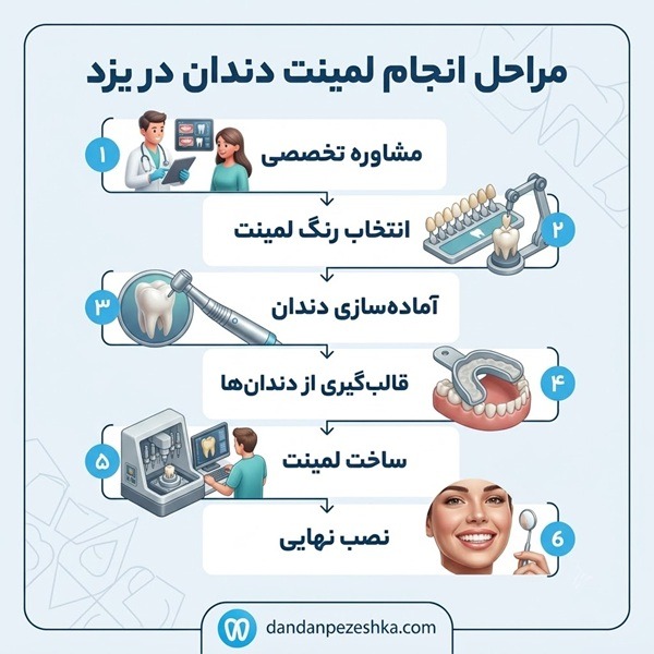 مراحل انجام لمینت دندان در یزد