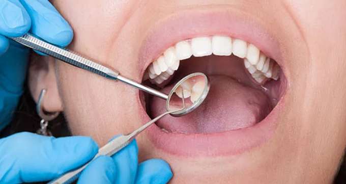 چه عواملی باعث آسیب به دندان می شوند؟