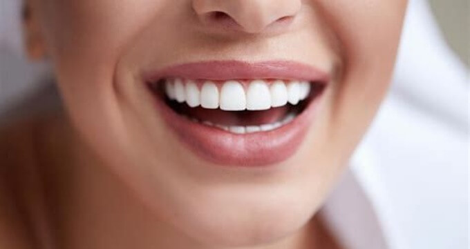 مزایای انجام کامپوزیت دندان