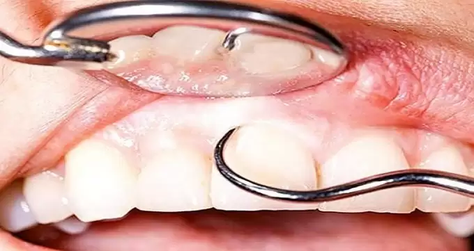 عوامل موثر در هزینه جراحی دندان