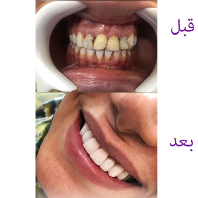 دکتر الناز جعفری زارع