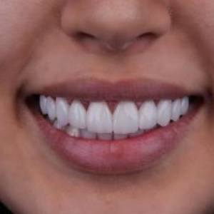 دکتر مهرانگیز احمدزاده