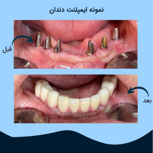 دکتر نادر نورزاده افشار