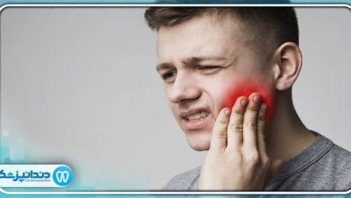 7 علت رایج دندان درد بعد از پر کردن