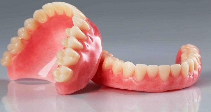 مقایسه ایمپلنت و دندان مصنوعی 