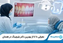 بهترین دکتر بلیچینگ در همدان
